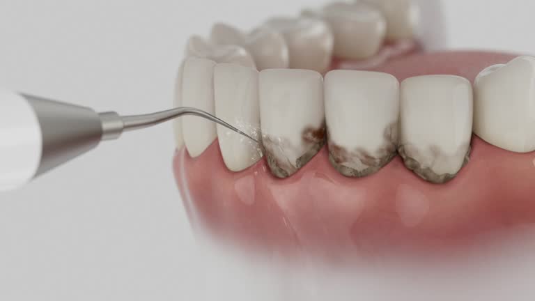 Trusted Root Canal Treatment service in Lisbon, OH - Dentist Open Now
